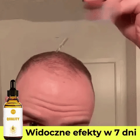 ScalpPro™ Olejek do Włosów na Szybki Wzrost Włosów